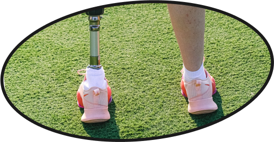 Athlete wearing runners with prosthetic leg